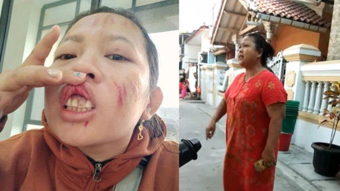 Seorang Ibu di Jakarta Dihajar Istri RT Hingga Babak Belur