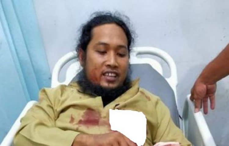 Kondisi Ustadz yang Ditusuk saat Ceramah Maulid Nabi di Aceh Membaik